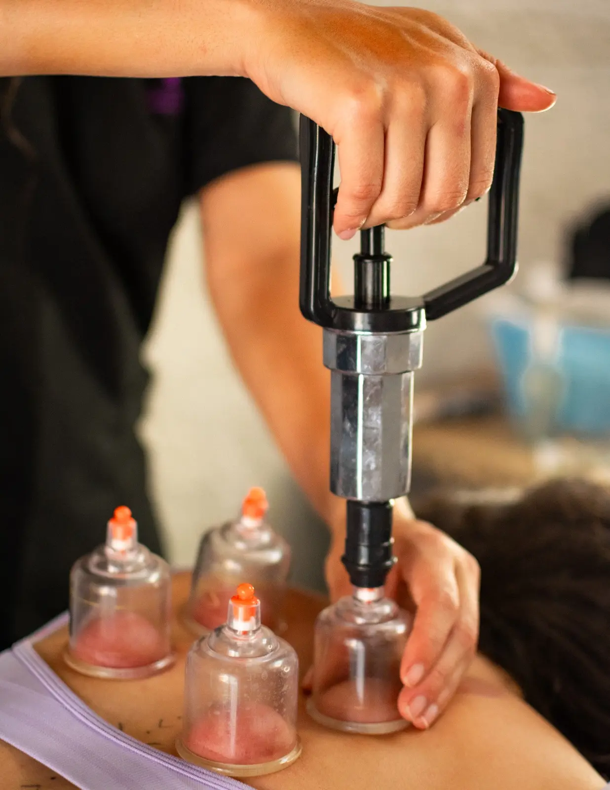 Terapia manual con cupping y electroterapia a domicilio en Medellín